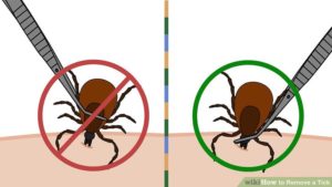 How to Remove a Tick